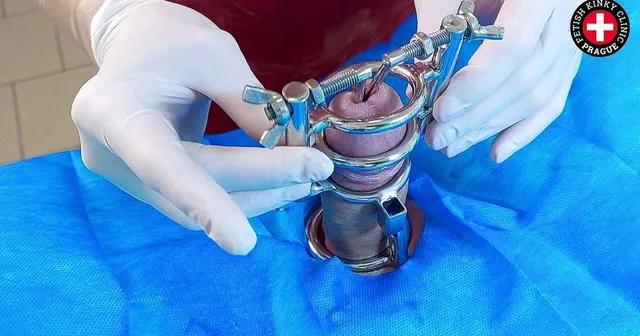 Urethral Stretching