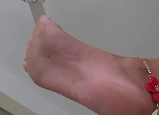 Foot And Ankle * Bracelets