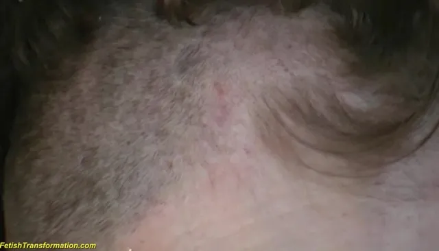 Loosing Hair